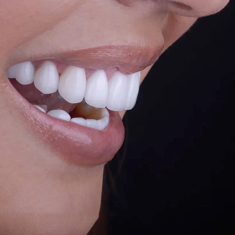 دندانپزشکی زیبایی